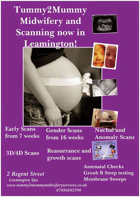 3d/4d baby ultrasound scans tummy2mummy photo